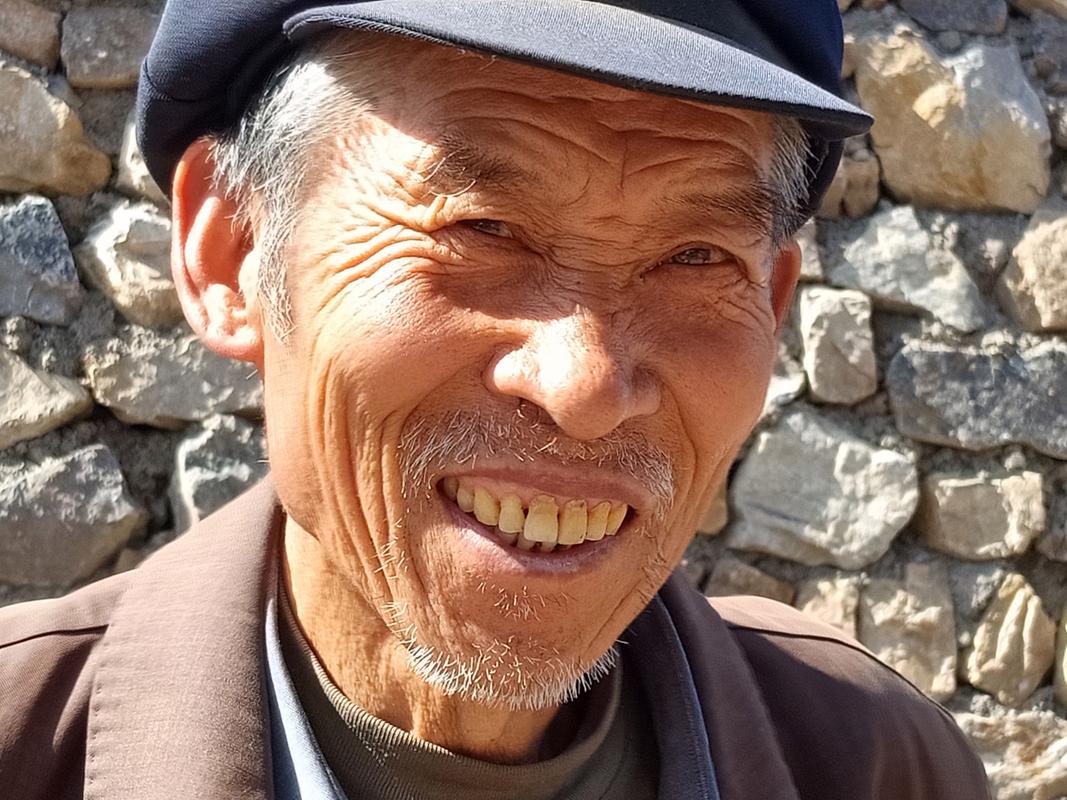 医保提取有什么影响吗？真相让你意想不到